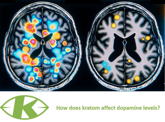 Dopamine - K-Tropix